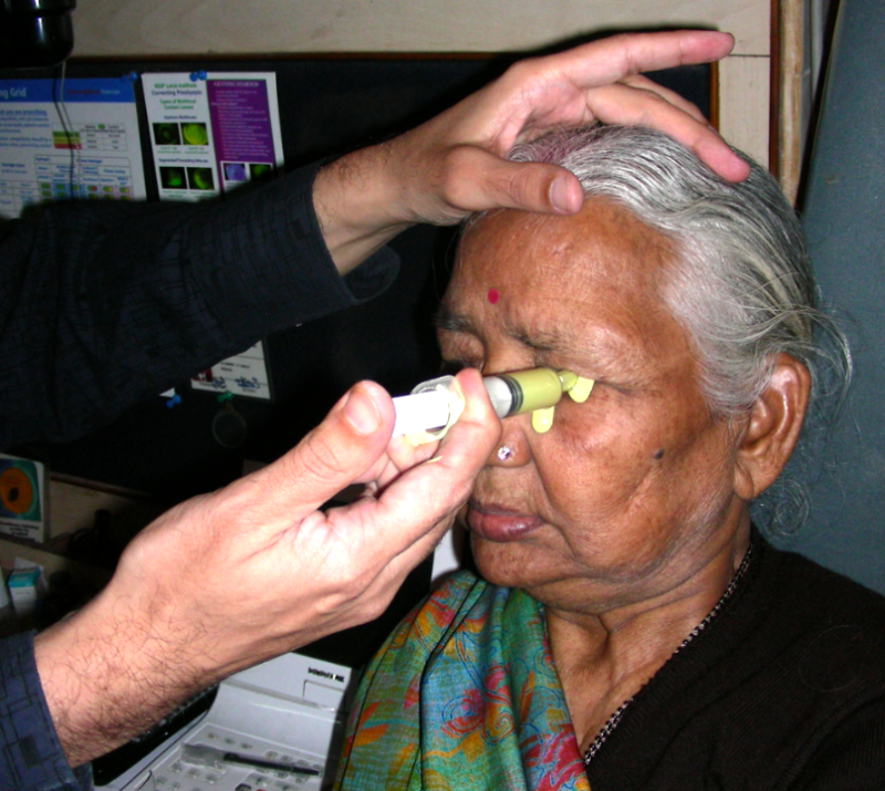 Artificial eye